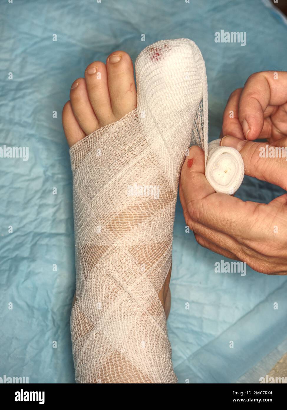 Helping to injured and cut toe and toe nail with blood soaking bandage