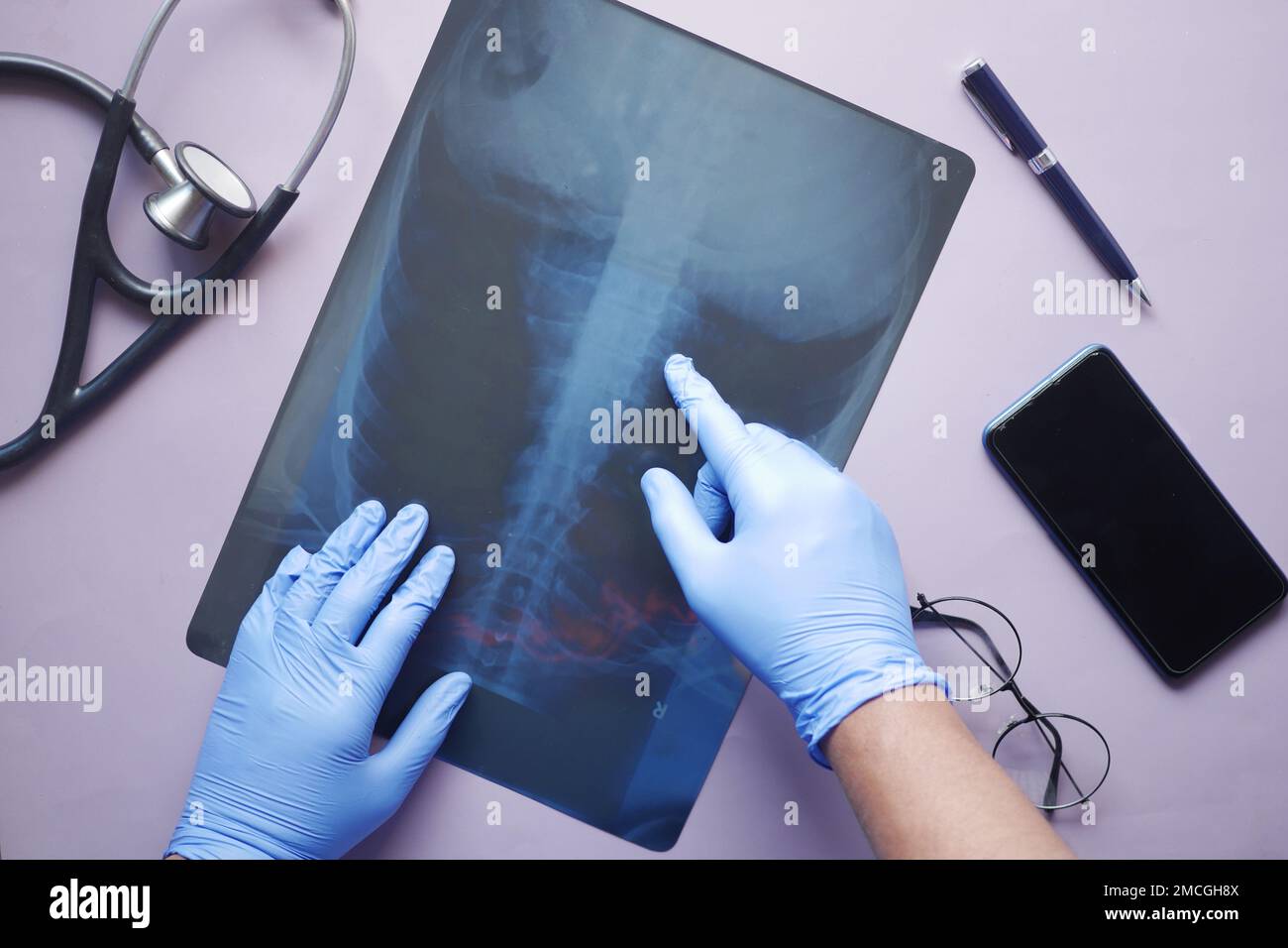 doctor hold analyzing xray photography, closeup Stock Photo