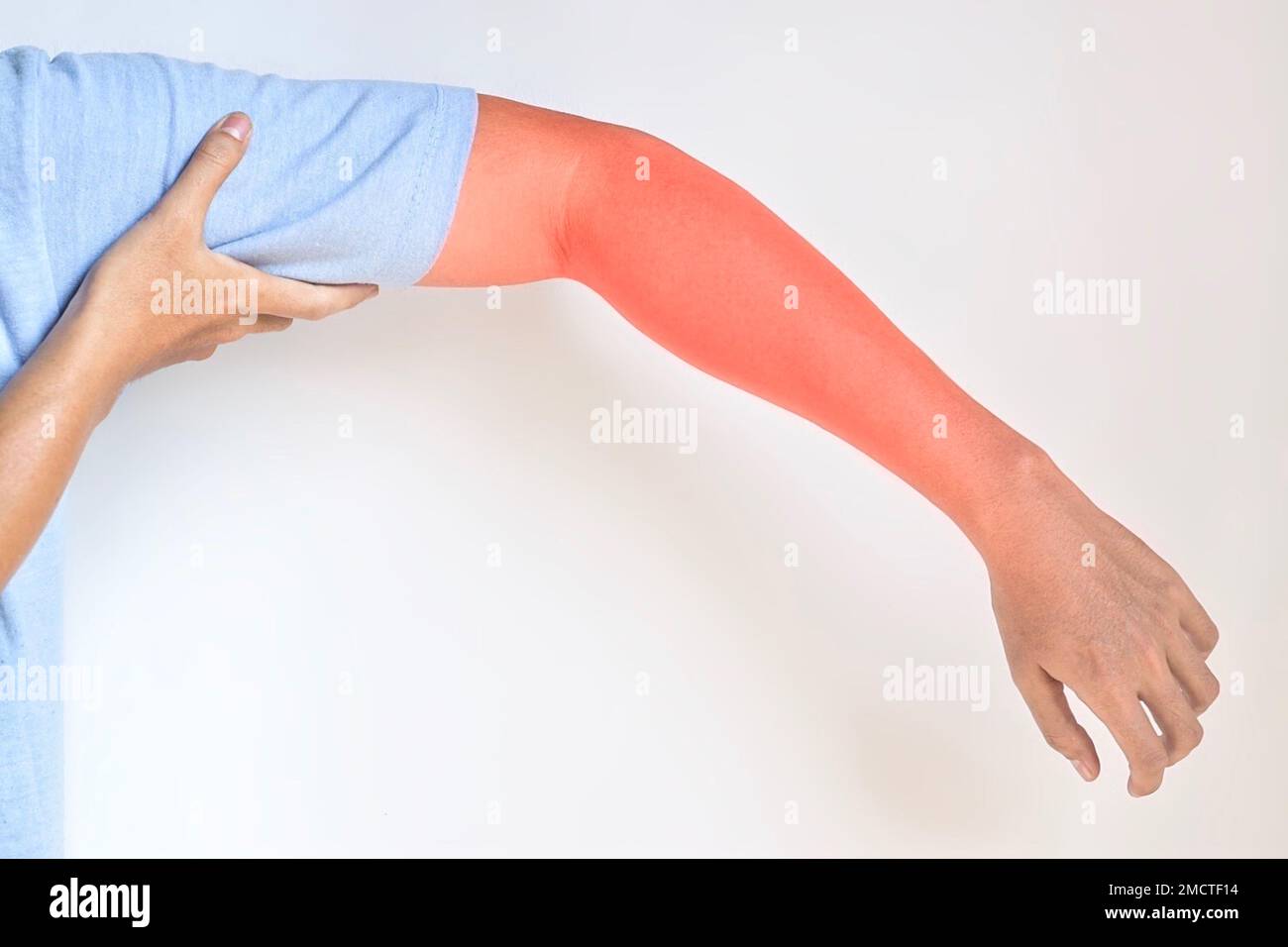Pain in the upper arm of Southeast Asian young man. Concept of elbow
