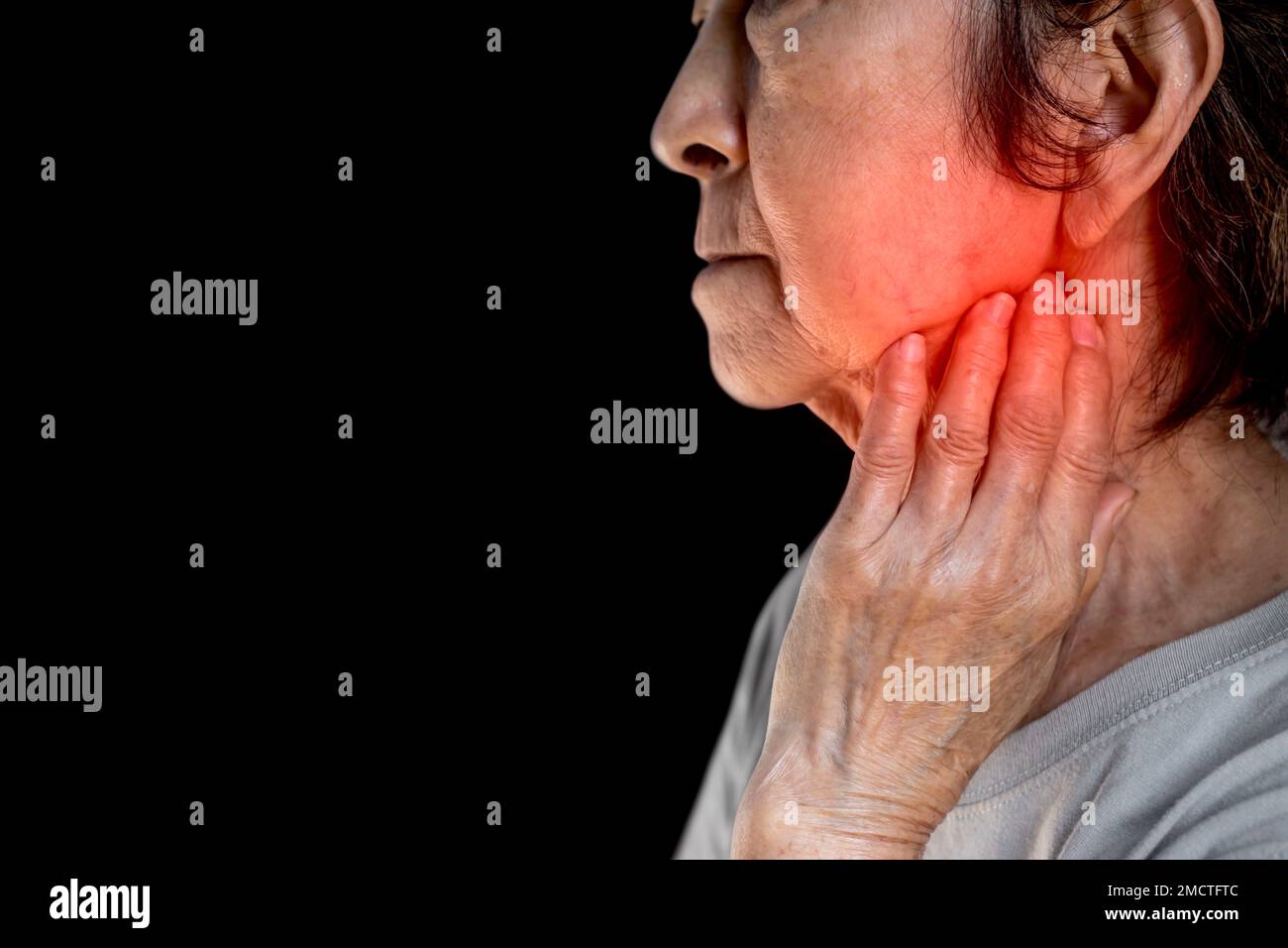 Inflammation at the jaw of Asian female patient. She feels wisdom toothache and lymph node pain. Stock Photo