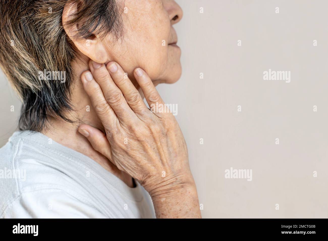 Pain at the jaw of Asian female patient. She feels wisdom toothache and lymph node pain. Stock Photo