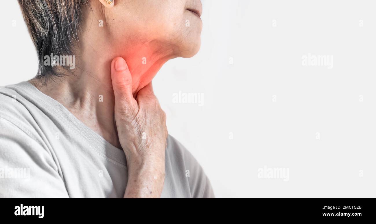 Redness at the neck of Asian, Myanmar woman. Concept of sore throat, pharyngitis, laryngitis, esophagitis, thyroiditis, or dysphagia. Stock Photo