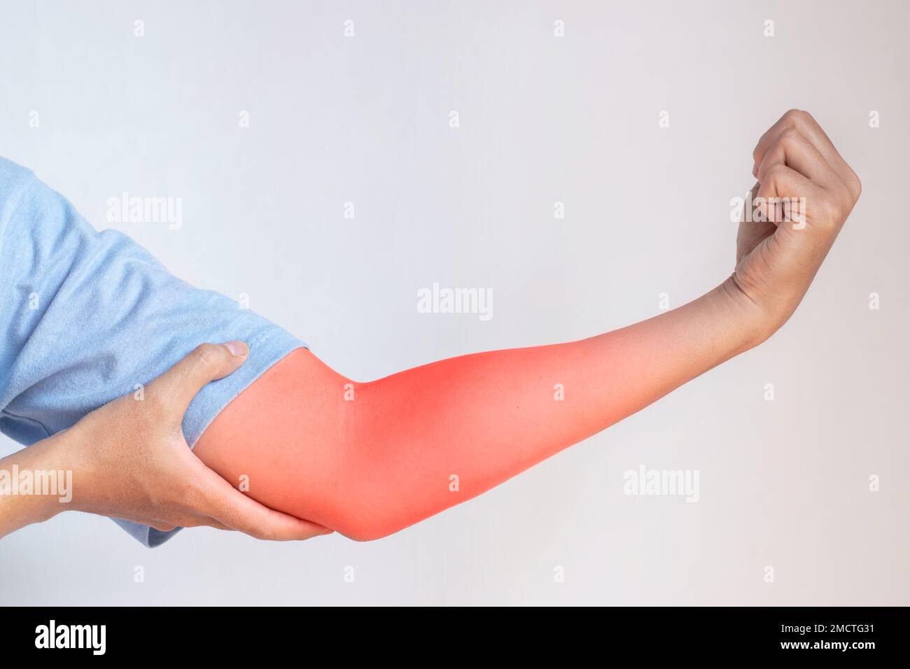 Pain in the upper arm of Southeast Asian young man. Concept of elbow