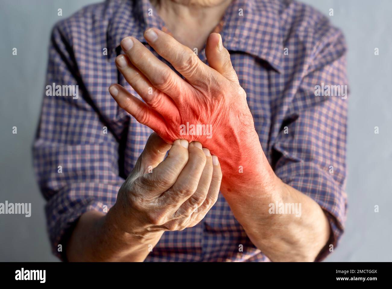 Asian elder woman scratching her hand. Concept of itchy skin diseases such as scabies, fungal infection, eczema, psoriasis, rash, allergy, etc. Stock Photo