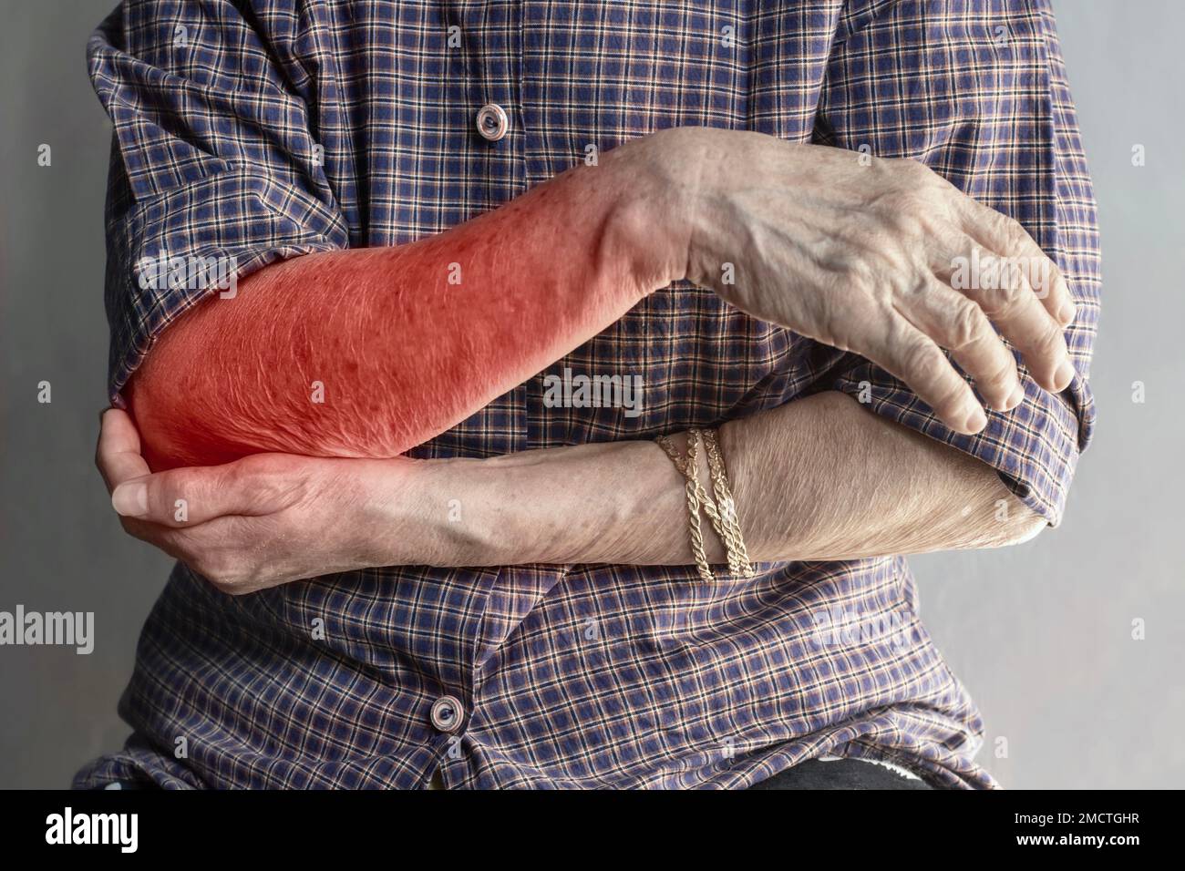Pain in the upper arm of Southeast Asian elder woman. Concept of elbow