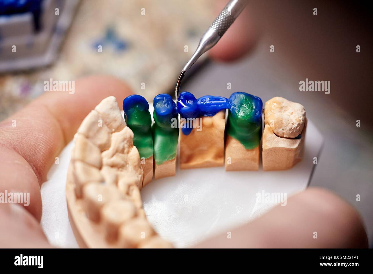 Dental technician dentist man working with dentures in his laboratory