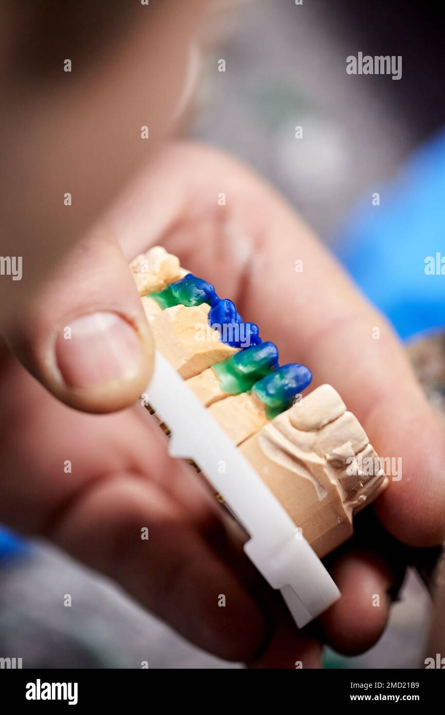 Dental technician dentist man working with dentures in his laboratory