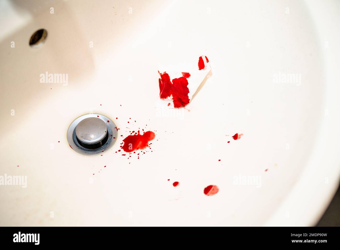 Red blood drops in white bathroom sink. Real blood as traces and evidence of a crime. Concept of nosebleed, injury, violence, murder or suicide. Blood Stock Photo