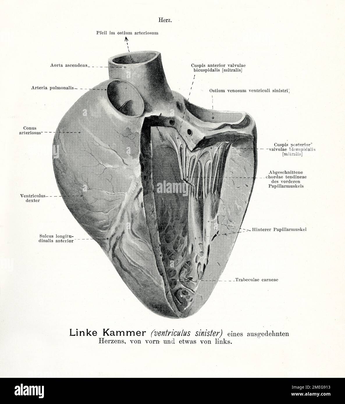 Vintage illustration of anatomy of the left ventricle of a  dilated heart, frontal and partial left view with German anatomical descriptions Stock Photo