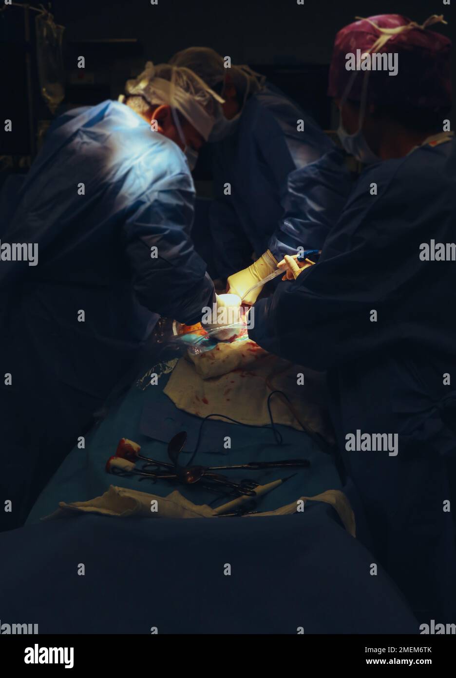 Classic cesarean section in the operating theater, labor room, newborn baby in delivery room Stock Photo