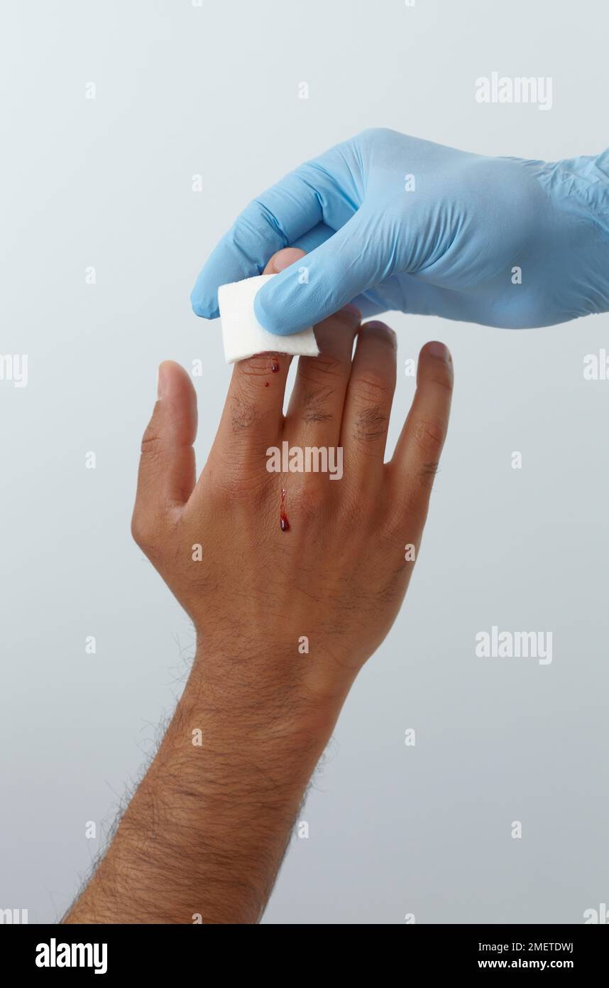 First aid treatment of finger injury, holding gauze pad on wound Stock