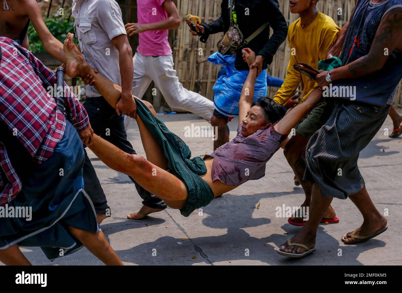 Anti-coup protesters carry an injured man after a clash with riot ...