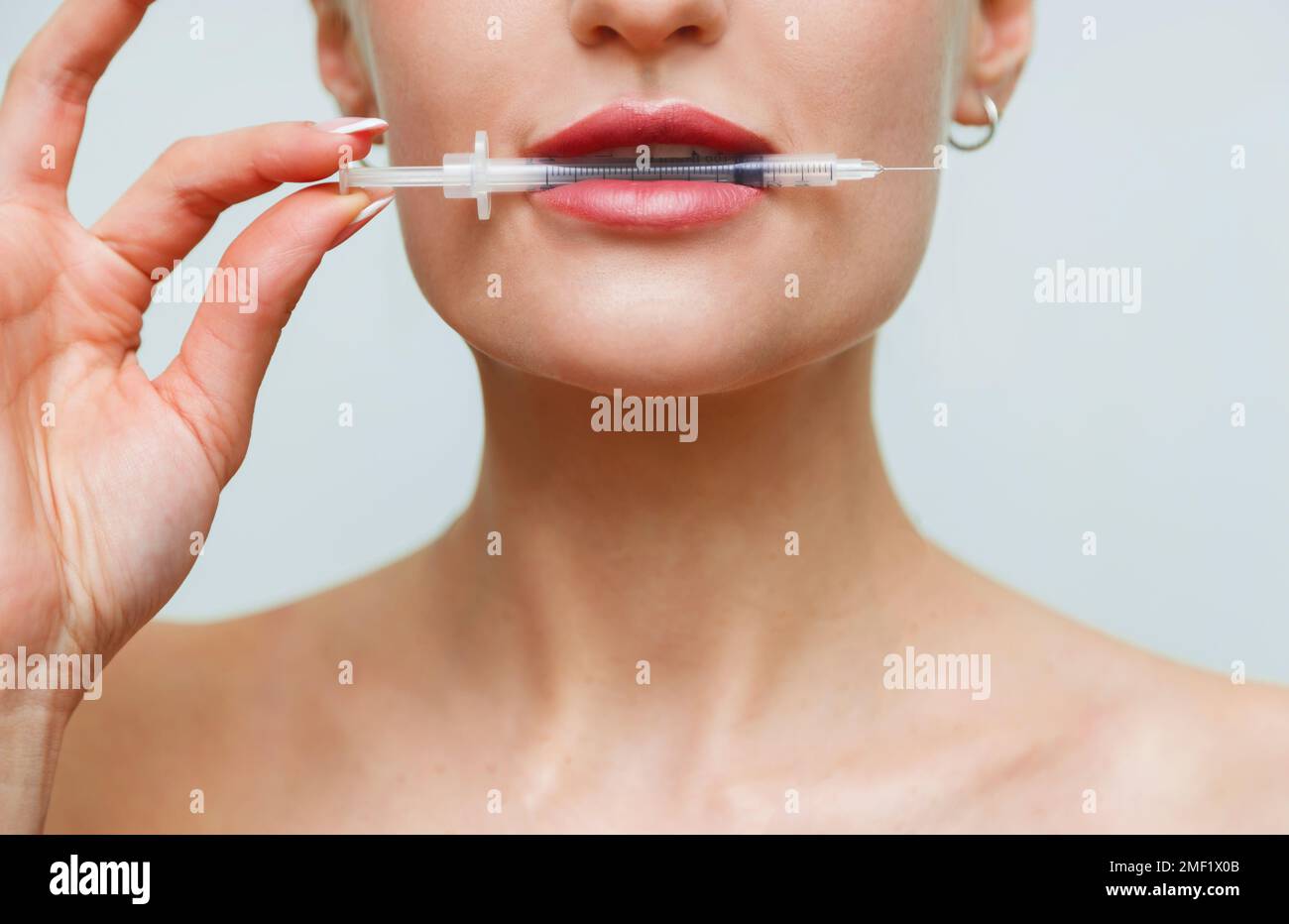 Closeup face young woman holds syringe in mouth. Hyaluronic acid