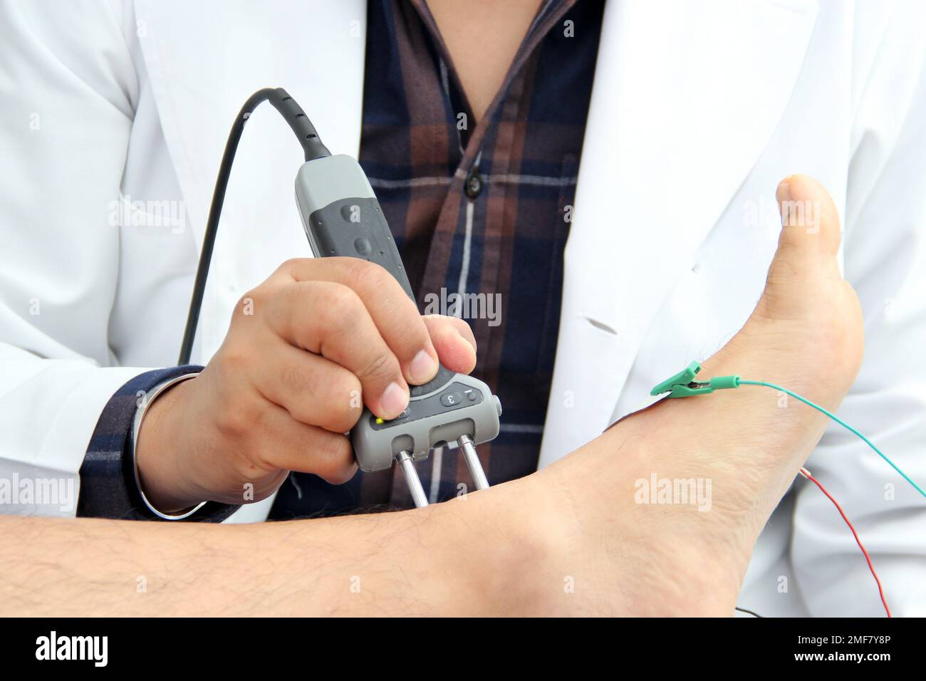 Somatosensory Evoked Potentials (SEP) or Nerve Conduction Velocity (NCV) is a test of electrical
