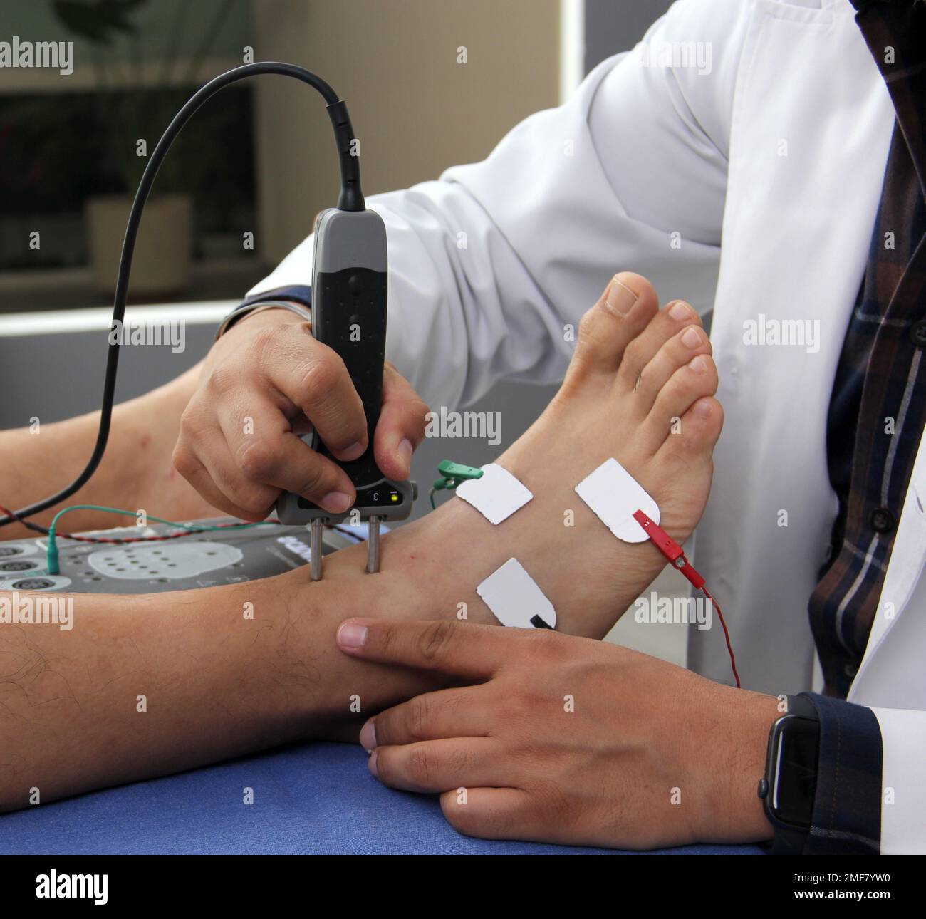 Somatosensory Evoked Potentials (SEP) or Nerve Conduction Velocity (NCV