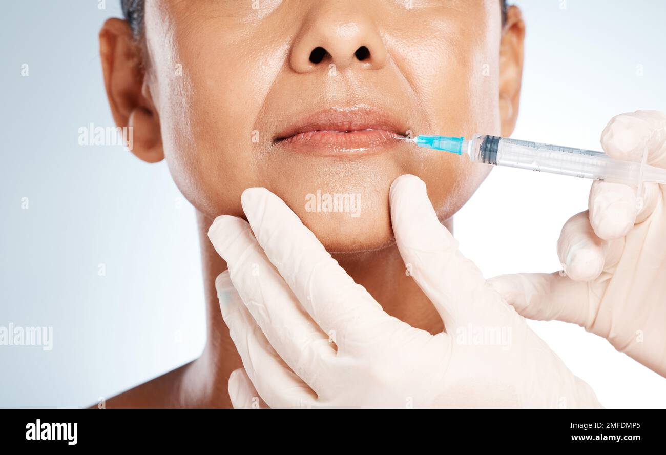 Injection, plastic surgery and lip filler on woman face for cosmetics, collagen and beauty salon. Skincare, facial needle and botox aesthetic Stock Photo