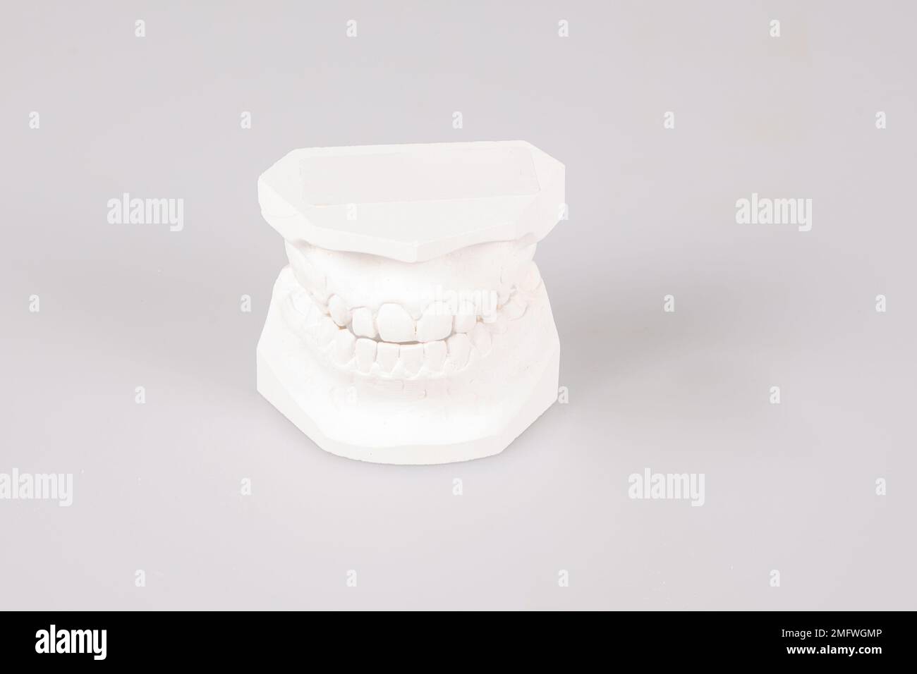dental implants print white plaster teeth in dental laboratory Stock