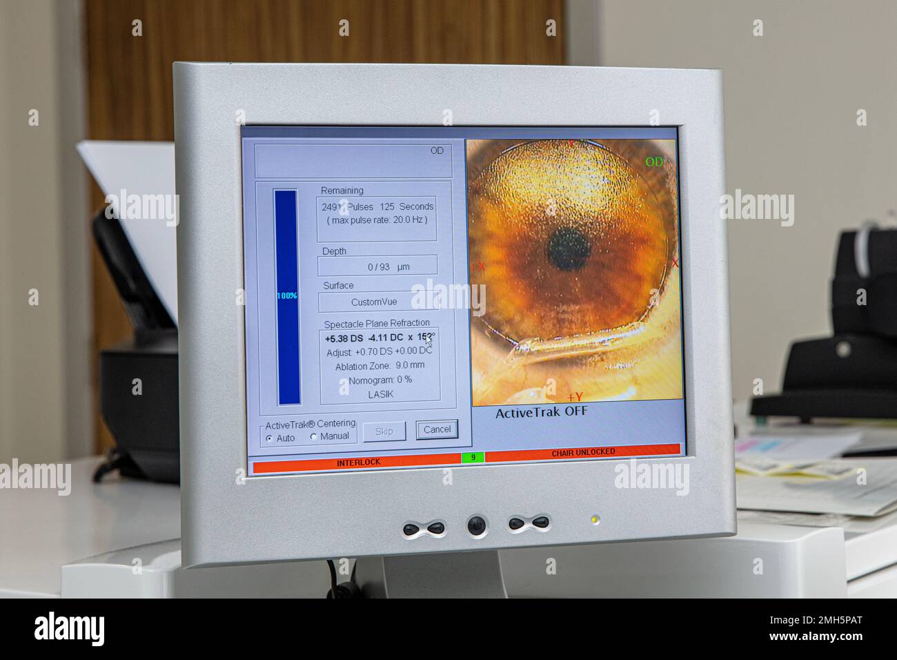 Laser vision correction.Patient and team of surgeons in the operating