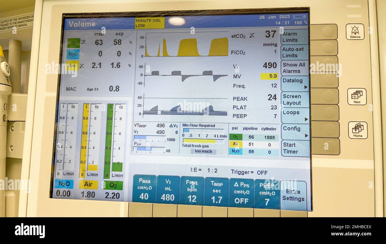 Hospital Monitors anesthesia machine blood pressure oxygen level heart