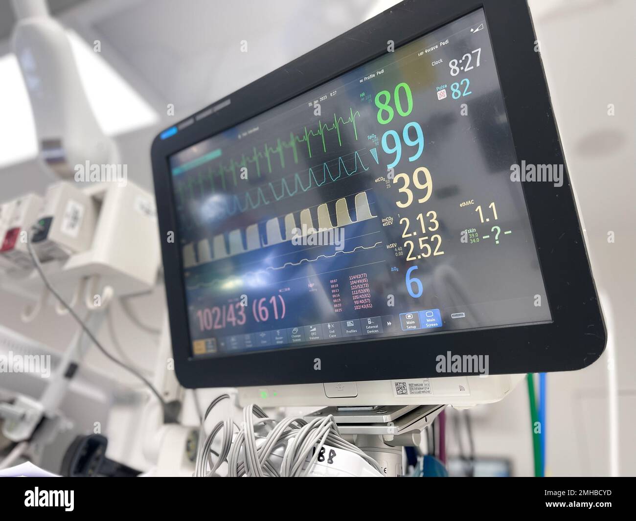 Hospital Monitors anesthesia machine blood pressure oxygen level heart