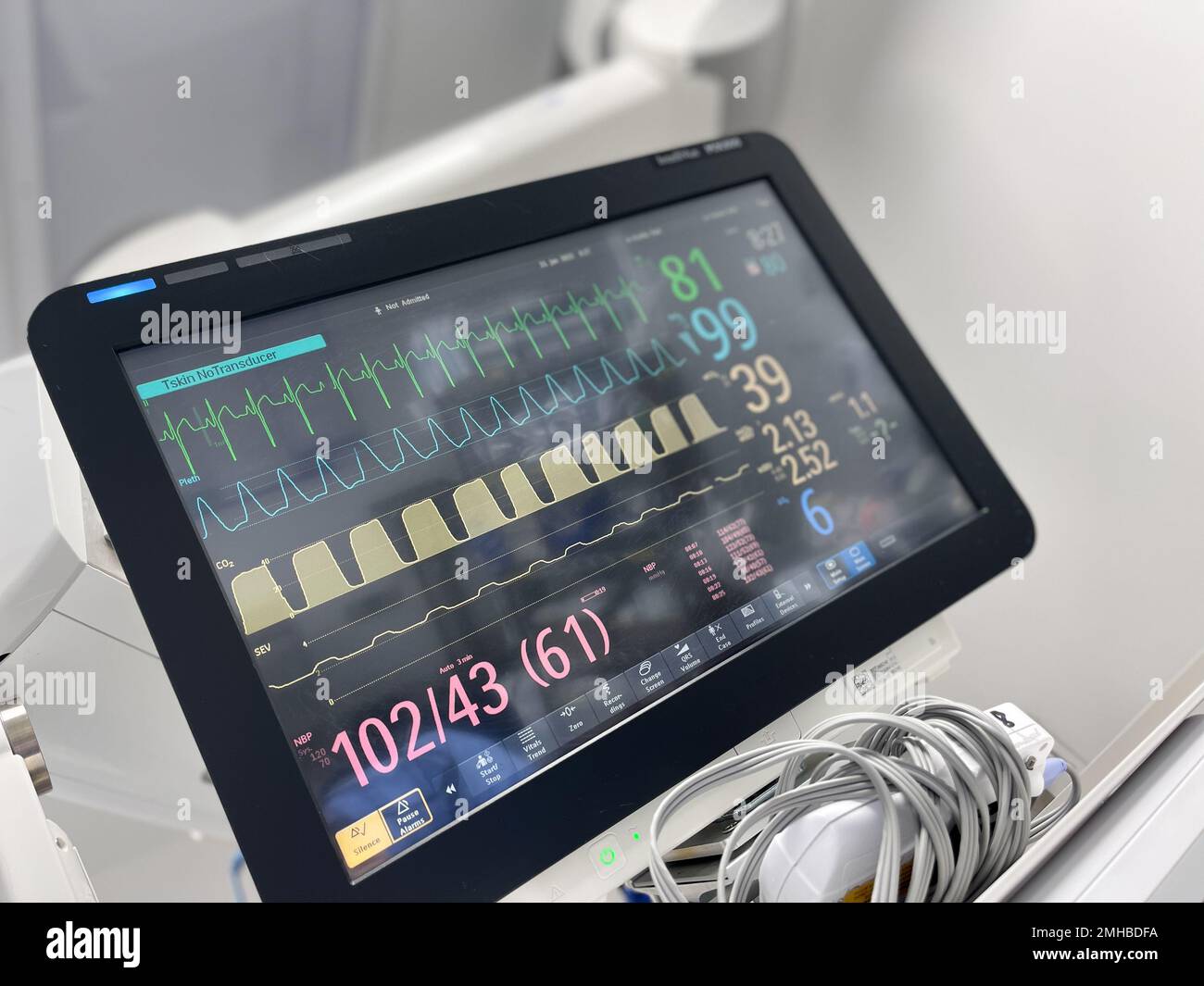 Hospital Monitors anesthesia machine blood pressure oxygen level heart