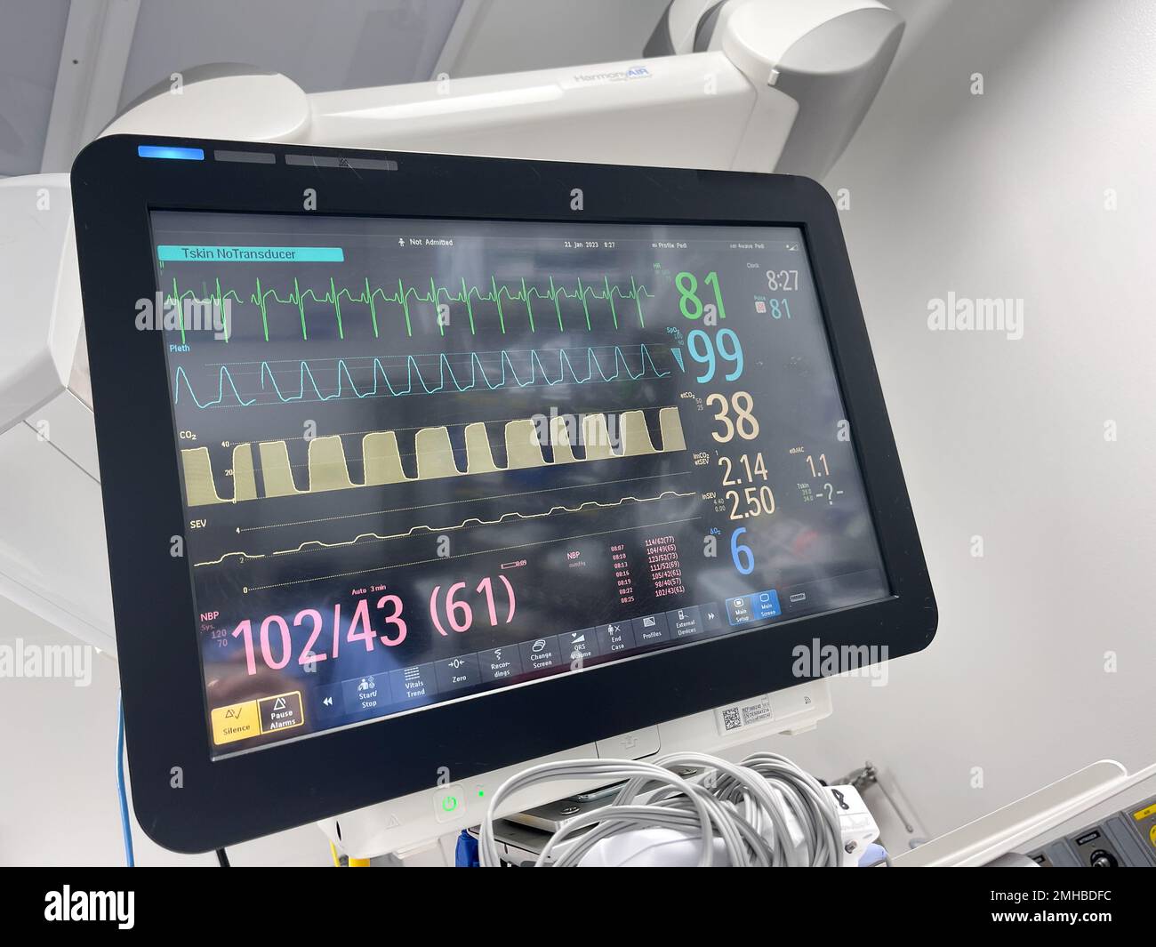 Hospital Monitors anesthesia machine blood pressure oxygen level heart