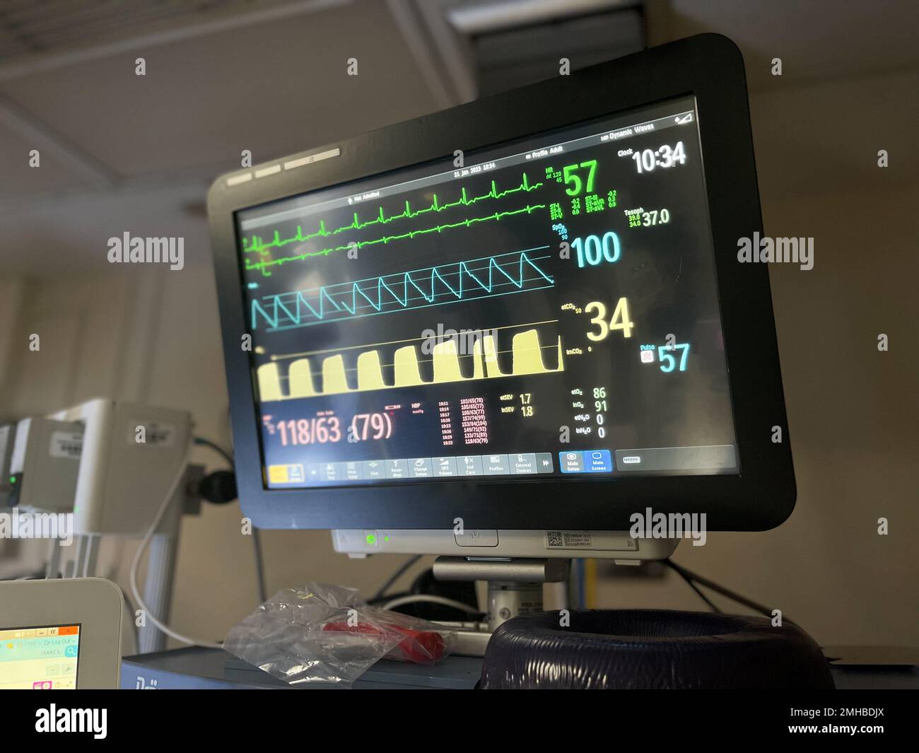 Hospital Monitors anesthesia machine blood pressure oxygen level heart