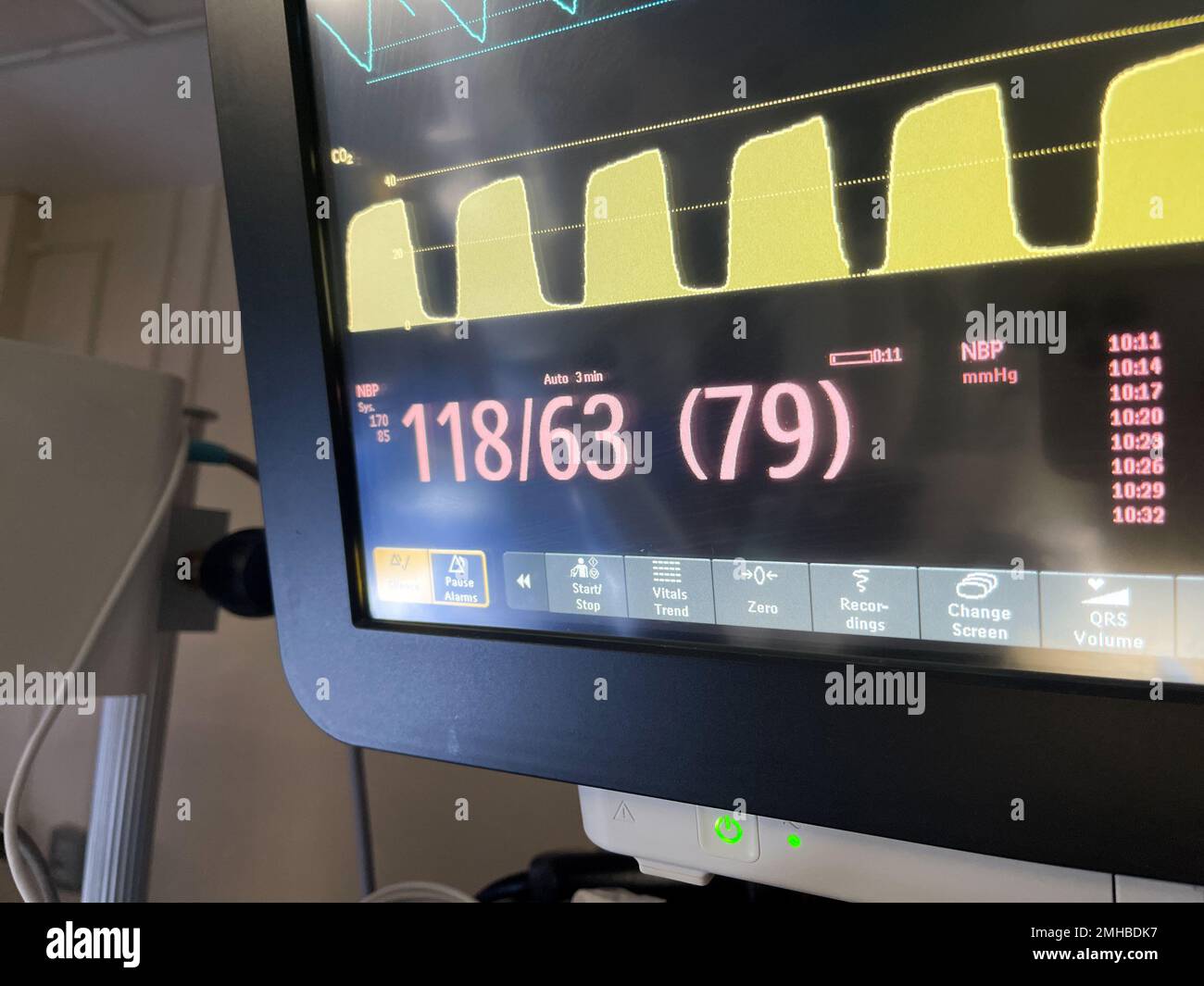 Hospital Monitors anesthesia machine blood pressure oxygen level heart