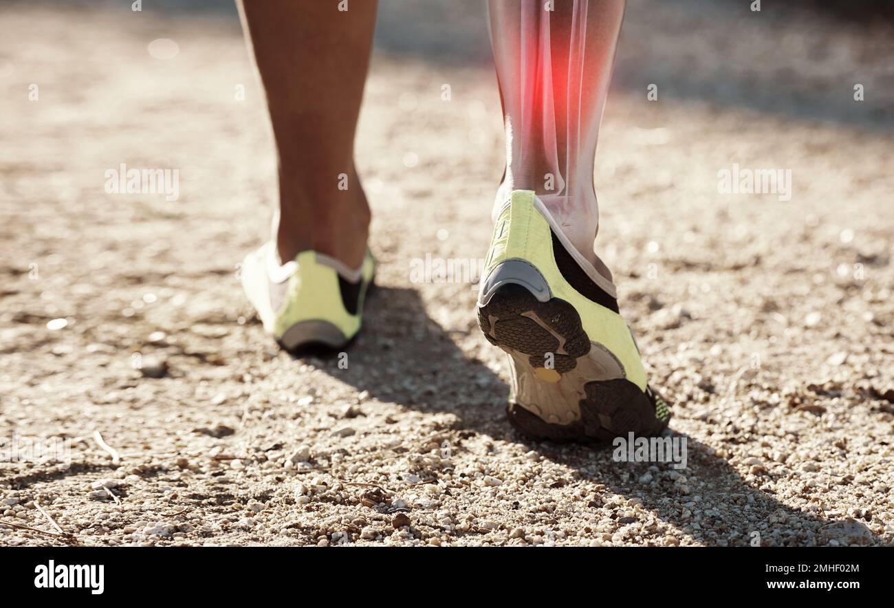 Legs, x ray and pain or injury of hiking fitness athlete training