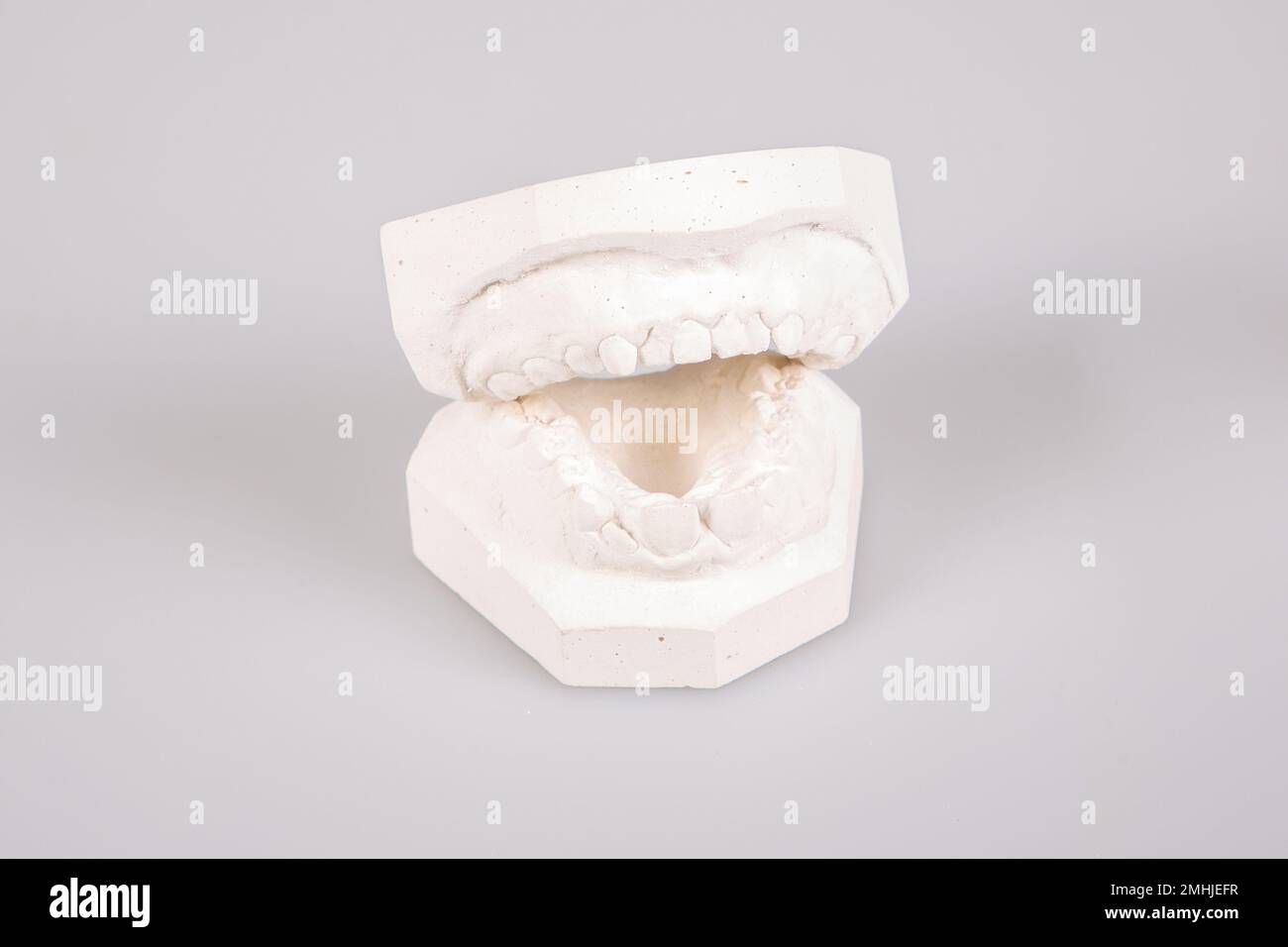 Making dental implants print plaster teeth dental laboratory Stock