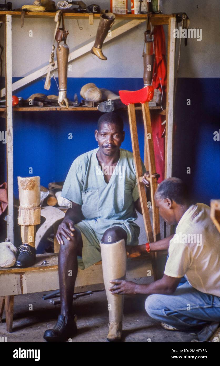 Zambia, Mongu, orthopedist measures a prosthetic leg on a man whose leg has been amputated Stock Photo