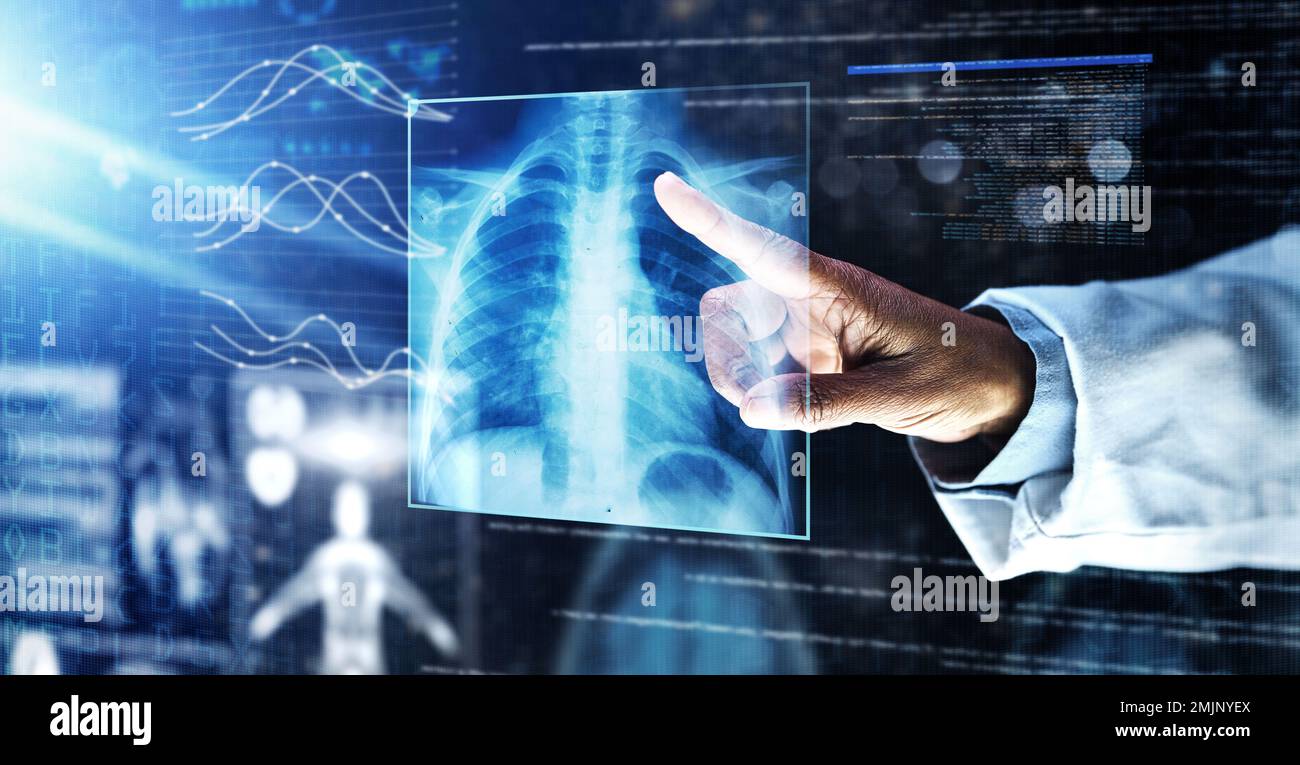 Doctor, healthcare or finger on xray hologram in tuberculosis virus, cancer analytics or asthma x ray at night. Futuristic, abstract or medical lungs Stock Photo