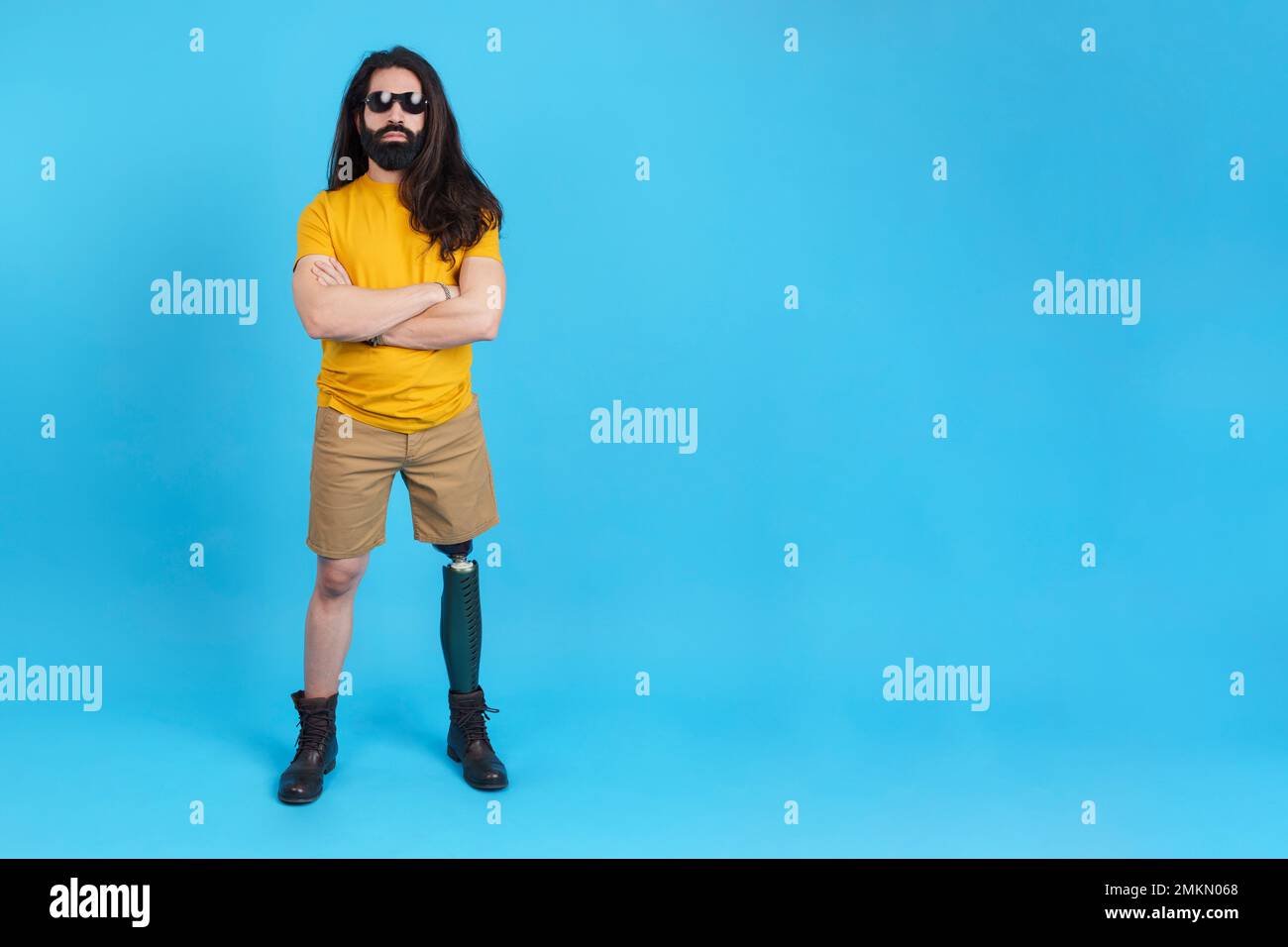 Serious man with arms crossed standing with a prosthetic leg Stock Photo