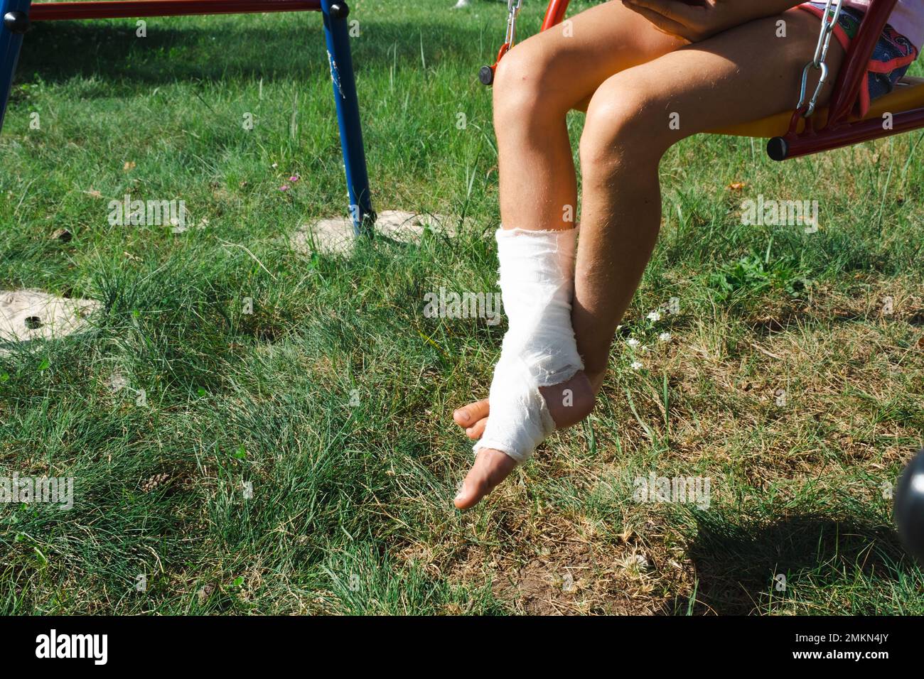 Children's legs are bandaged in plaster barefoot on a swing