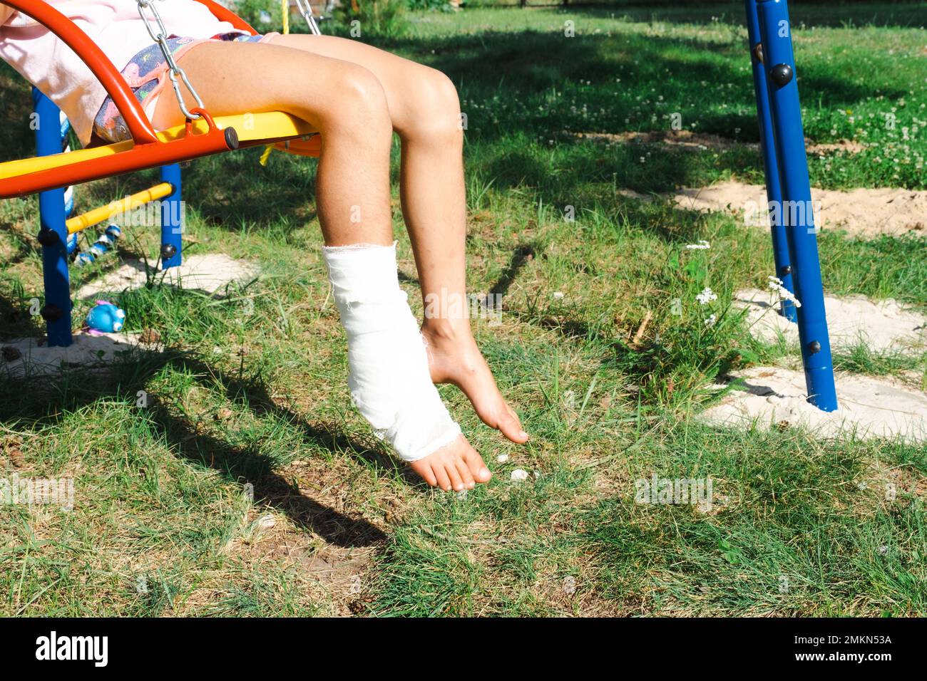 Children's legs are bandaged in plaster barefoot on a swing