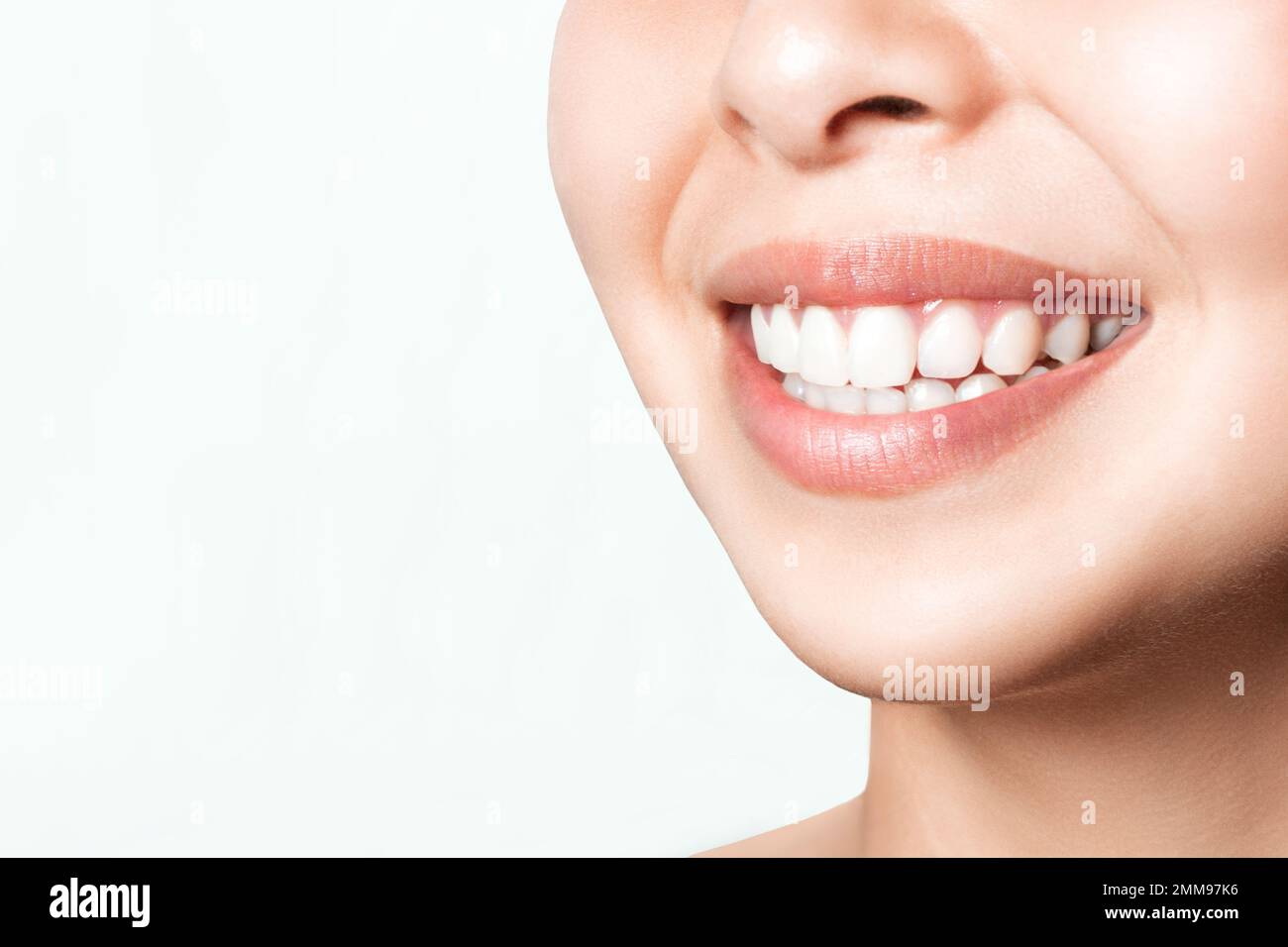 Asian female smile after teeth whitening procedure. Dental care