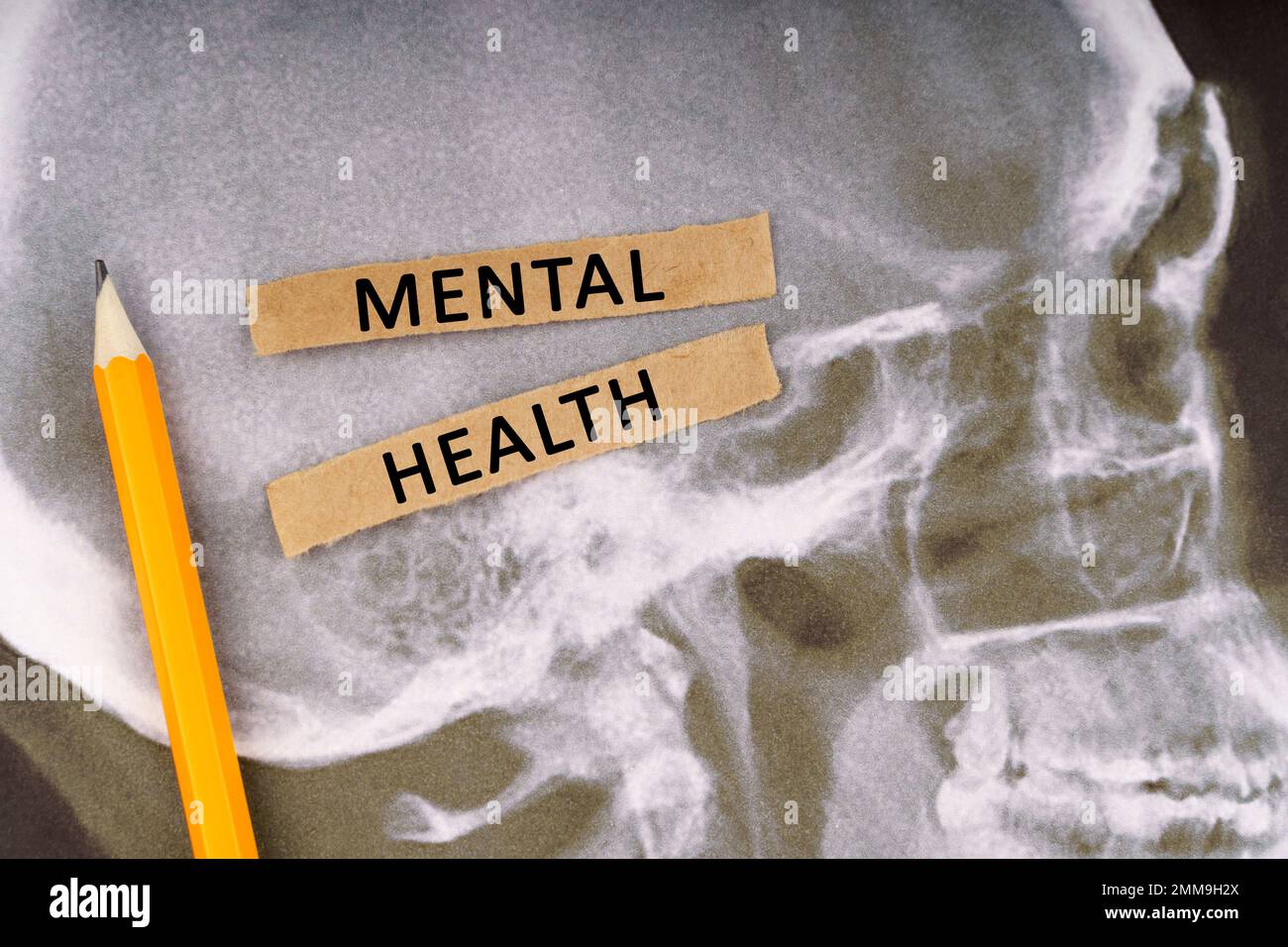 Medical concept. On x-rays of a human skull, a pencil and strips of ...