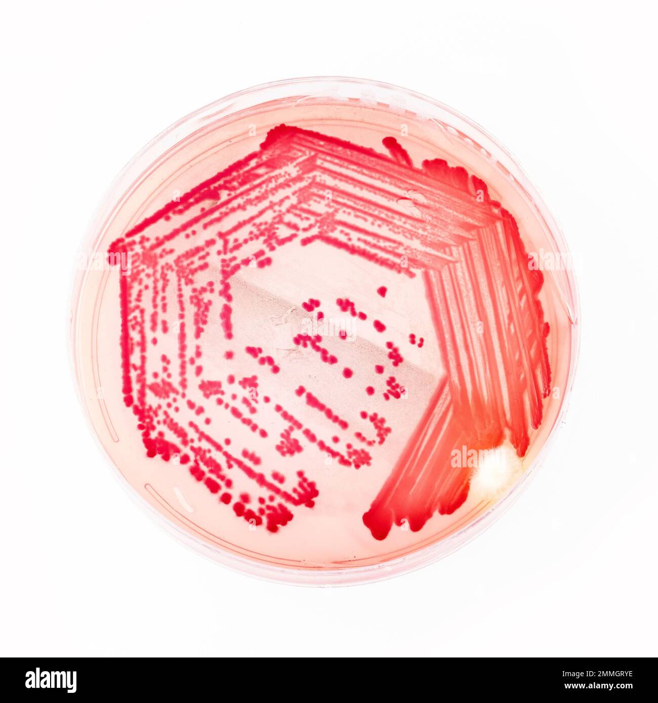 Helicobacter pylori, bacteria that infects the stomach Bacterial