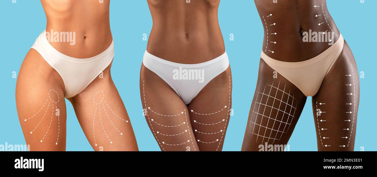 Millennial mixed race, european, black ladies in bikini with slim body with lines for figure shaping Stock Photo