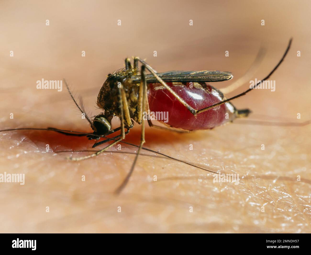 Close-up of a Culex mosquito biting human skin, abdomen full of blood visible. Stock Photo