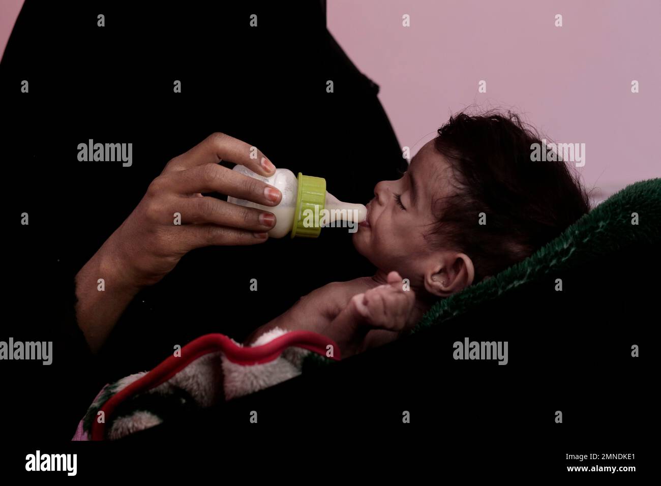 Ahmed Rashid Mokbel, a severely malnourished 7-month-old Yemeni 
