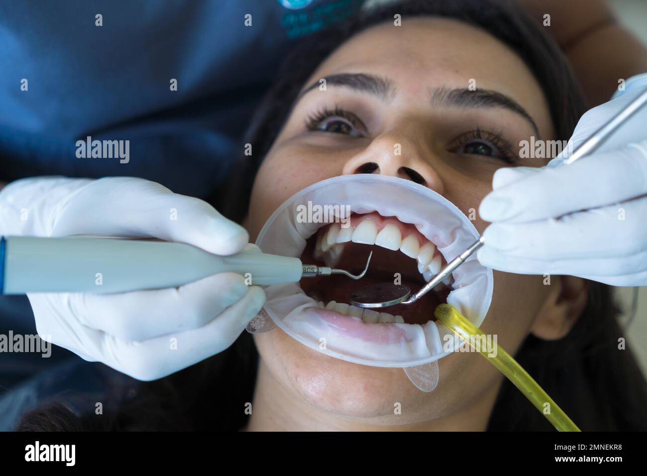 A woman's teeth are being treated at the clinic. An orthodontist uses