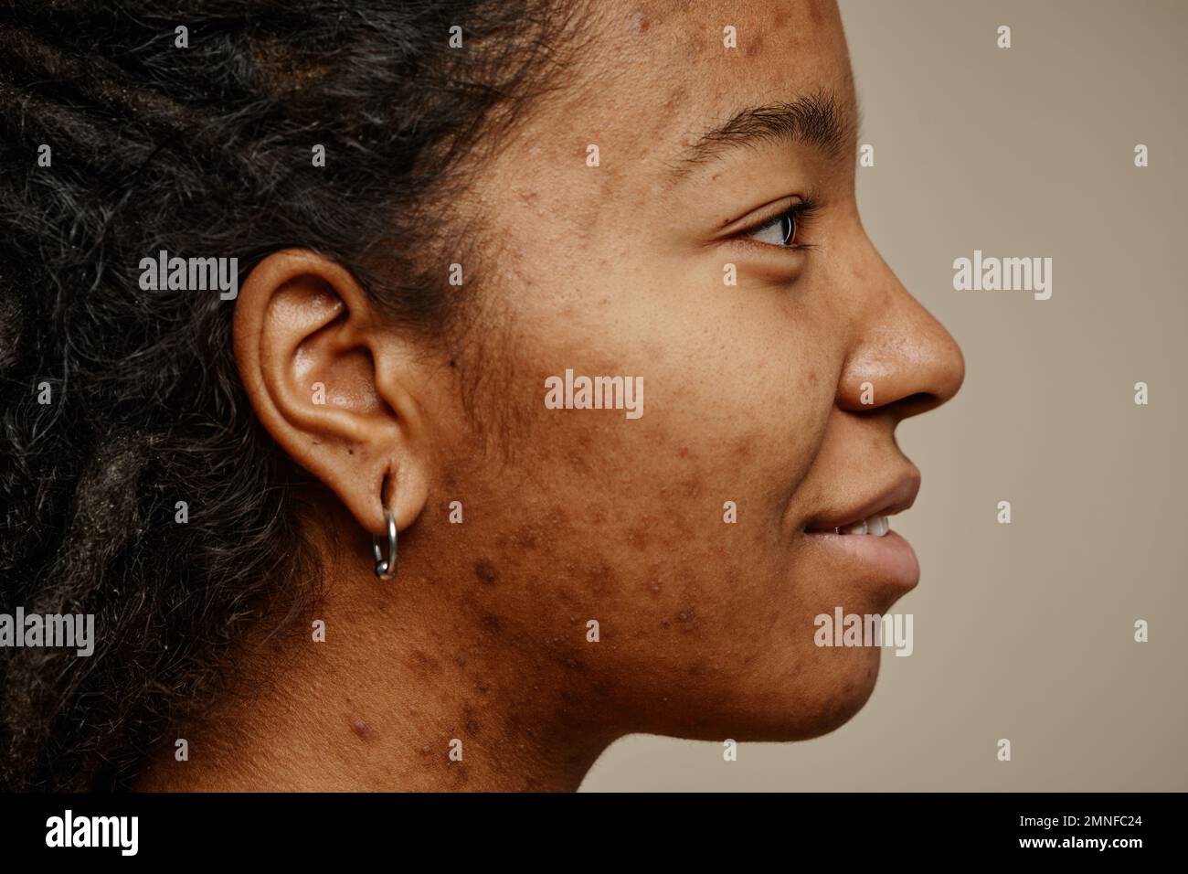 Minimal profile portrait of ethnic young woman smiling with acne scars on face and ear piercings Stock Photo