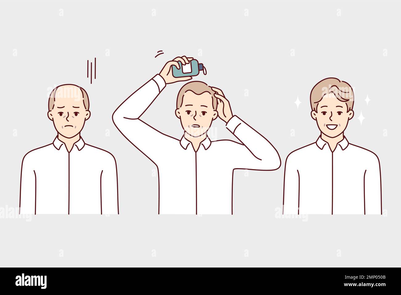 Man using hair growth gel rejoices after seeing good result of cosmetic product. Sad guy uses cream to get rid of baldness on head and get desired bouffant hairstyle. Flat vector illustration Stock Vector
