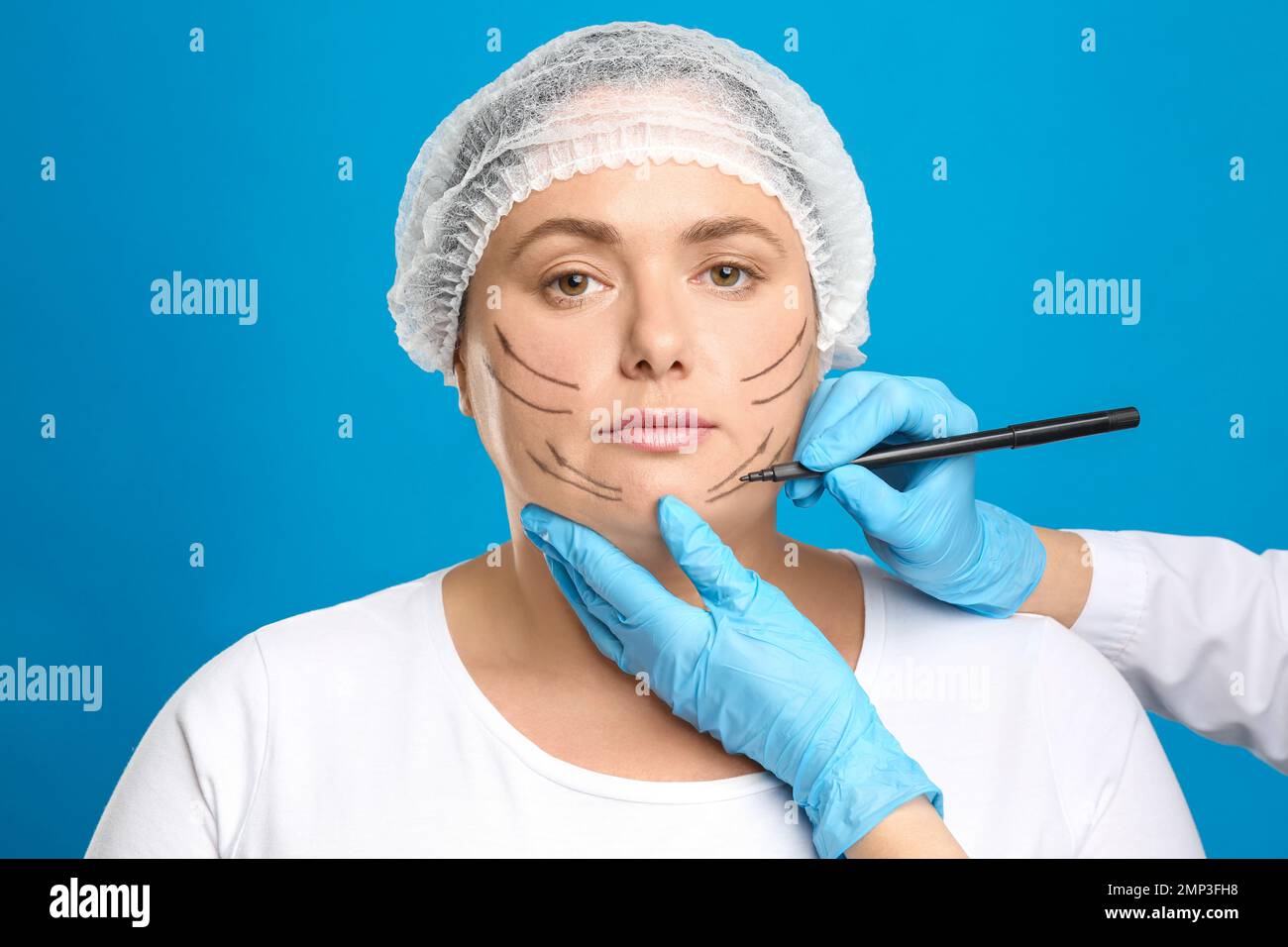 Doctor Drawing Marks On Womans Face For Cosmetic Surgery Operation Against Blue Background 7292