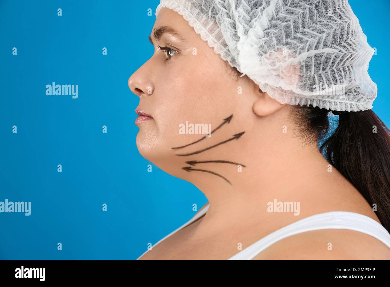 Woman with double chin ready for cosmetic surgery operation on blue ...