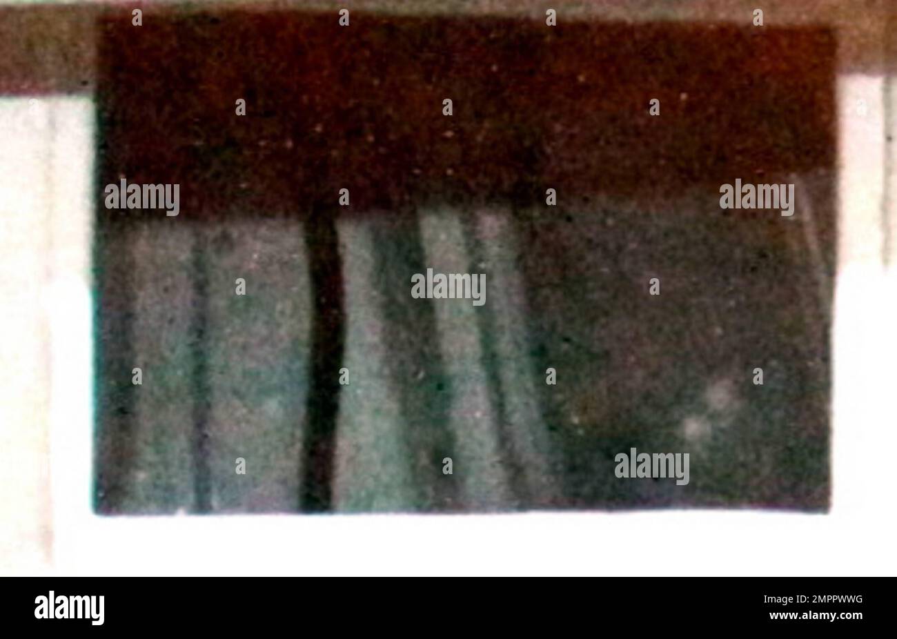 Whitney houston autopsy pics