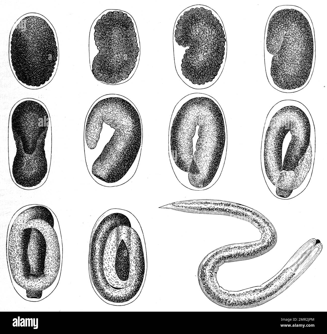Entwicklung eines Nematoxys, Nesselzelle, Historisch, digital
