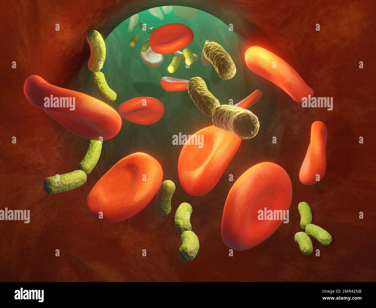 Bacterial infection inside a blood vessel. Digital illustration, 3D rendering. Stock Photo