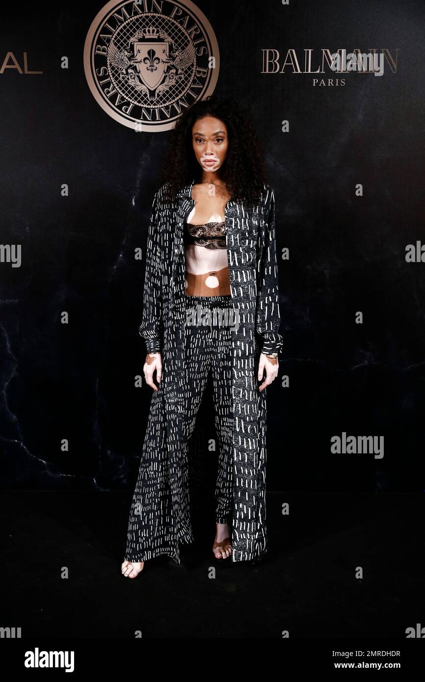 Model Winnie Harlow poses during a photocall for the L'Oreal Balmain